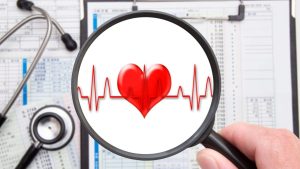 『不整脈』のサインに注意！ 『脳梗塞』を防ぐ早期発見と予防法【医師解説】