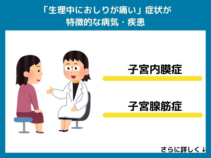 「生理中におしりが痛い」症状が特徴的な病気・疾患