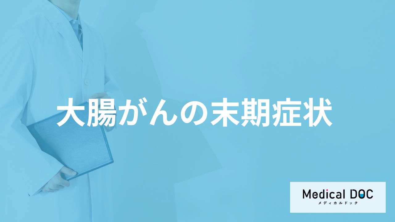 「大腸がんの末期症状」はご存知ですか？【医師監修】