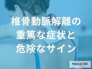 椎骨動脈解離の重篤な症状と危険なサイン