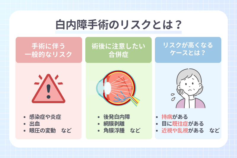 白内障手術のリスクとは？知っておくべきポイント
