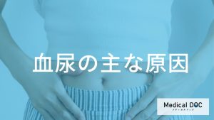 無症状の「血尿」は“膀胱がん”のサイン？ 原因となる病気や症状を解説！【医師監修】