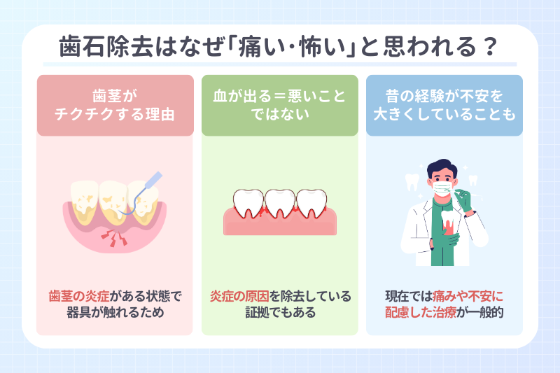歯石除去はなぜ「痛い・怖い」と思われるのか