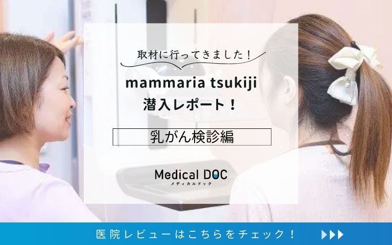 mammaria tsukijiphoto
