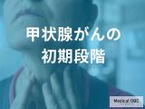 「甲状腺がんの初期症状」とは？”しこりの特徴”や見つけるための検査法を解説！