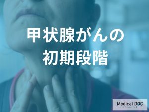 「甲状腺がんの初期症状」とは？”しこりの特徴”や見つけるための検査法を解説！