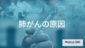 肺がんの主な原因とメカニズム