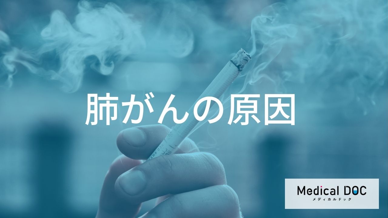 肺がんの主な原因とメカニズム