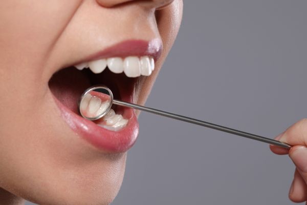 その症状、歯周病かも！？進行段階別にわかるサインと治療の考え方