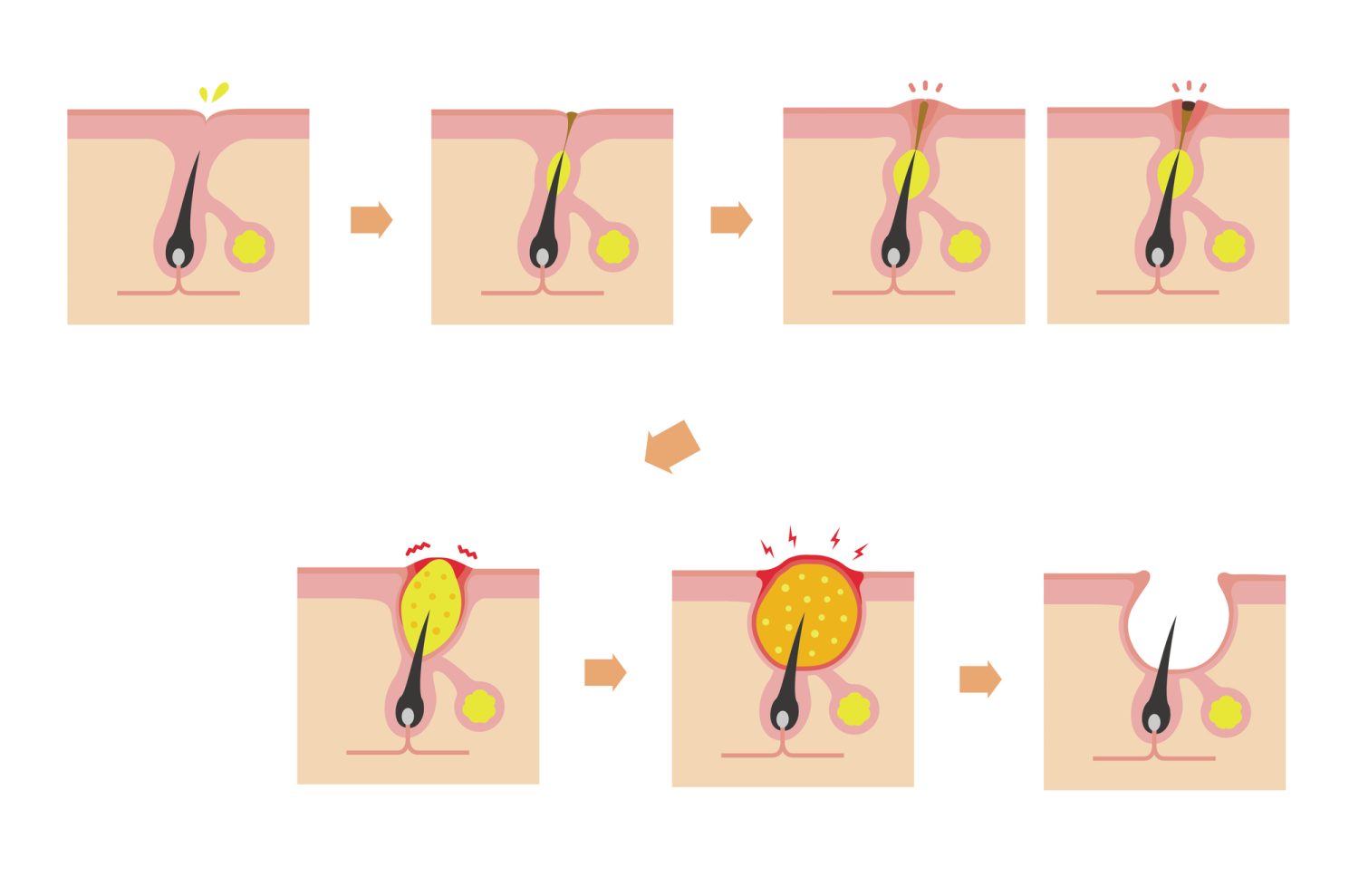 早めにおこなうことの意義は? 治療が遅くなるとどうなる?