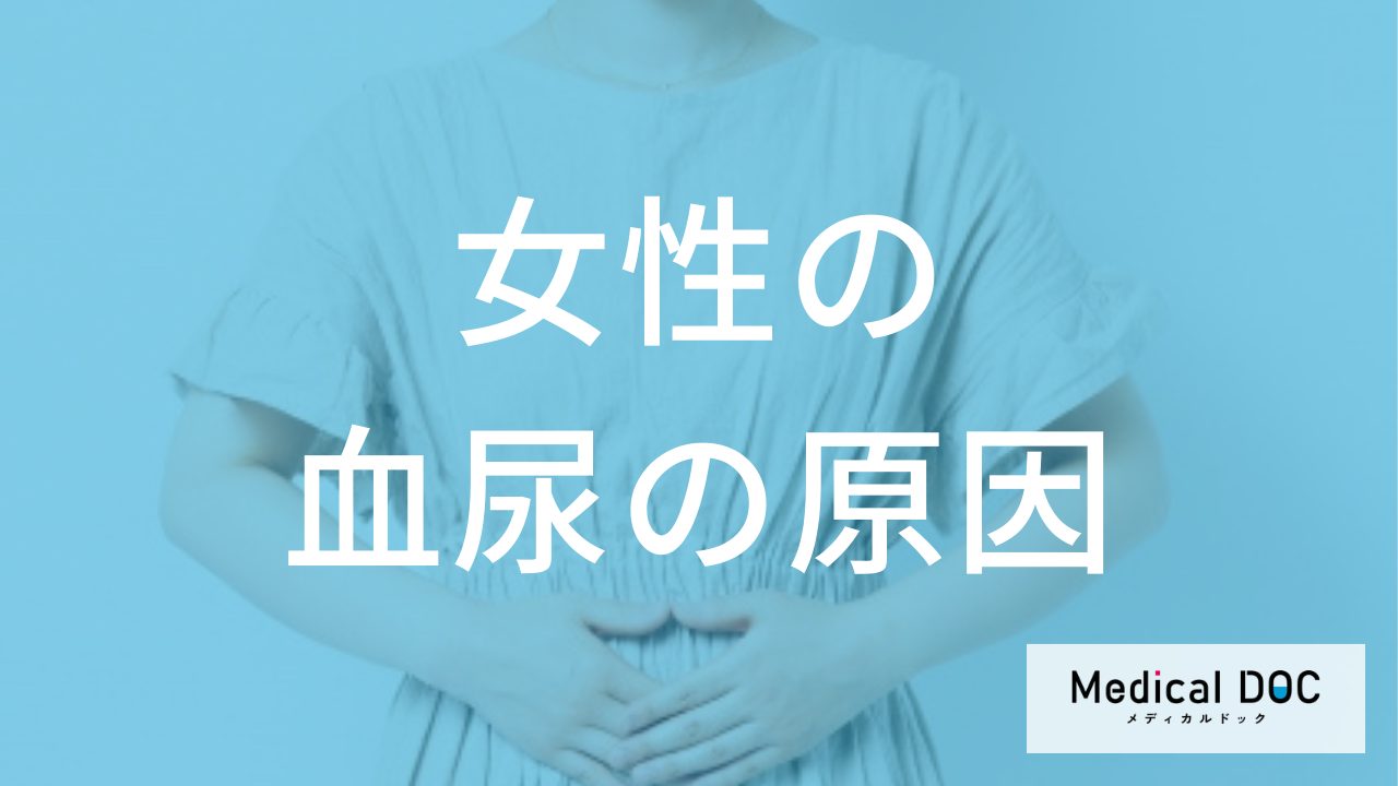 何を飲むと「血尿」の再発を抑えやすい?女性に多い膀胱炎との”予防法”を医師が解説