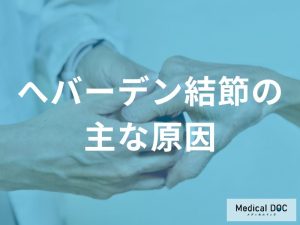 へバーデン結節になる4つの原因を医師が解説