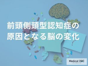 前頭側頭型認知症の原因となる脳の変化