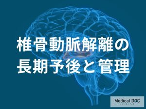 椎骨動脈解離の長期予後と管理