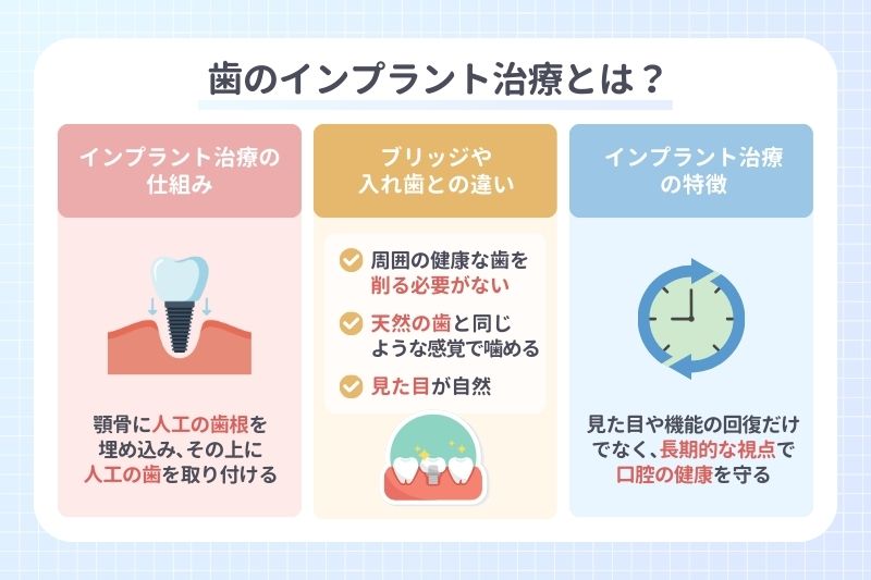 歯のインプラント治療とは？