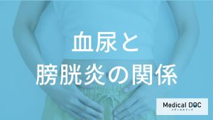「血尿」が止まった後も薬は必要？膀胱炎を長引かせないためのコツを解説！