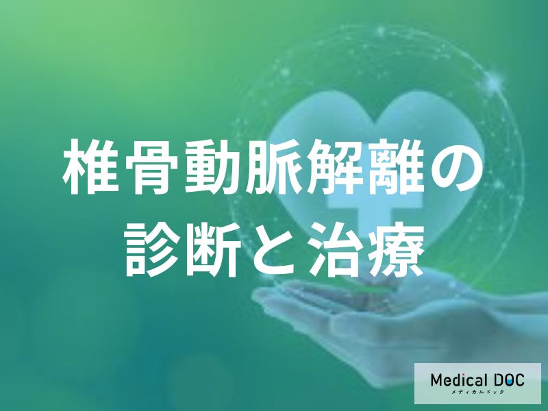 椎骨動脈解離の診断と治療の実際
