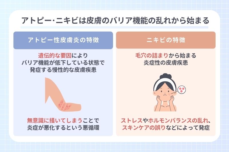 アトピー･ニキビは皮膚のバリア機能の乱れから始まる