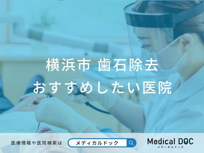 東京都 歯石除去