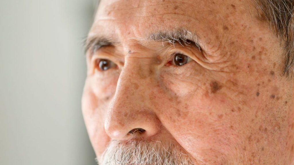 両眼の『白内障手術』は同日か別日か？ メリット・デメリットを比較【医師解説】