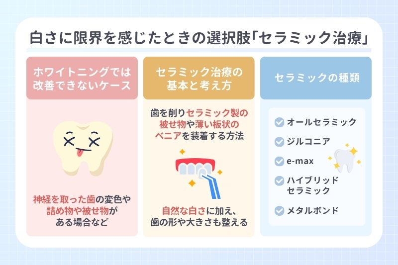 白さに限界を感じたときの選択肢「セラミック治療」