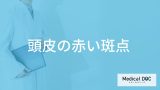 「頭皮の赤い斑点」は放置しても大丈夫？考えられる原因と対処法を医師が解説！