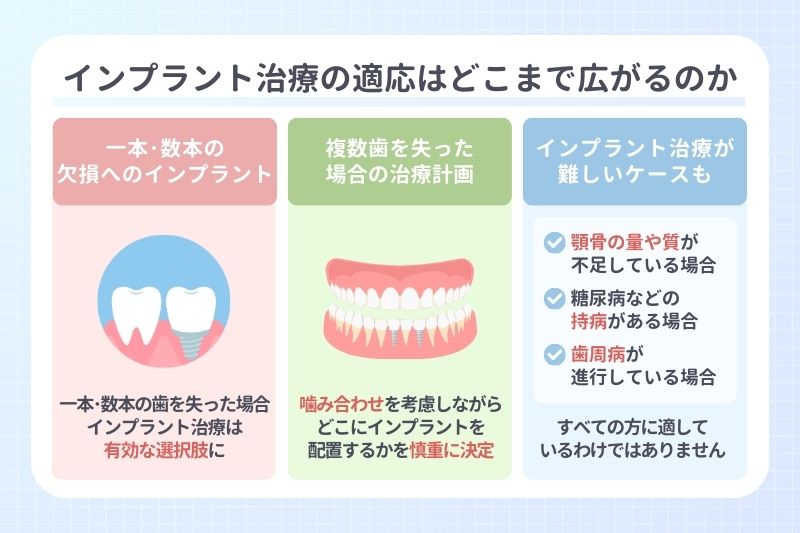 インプラント治療の適応はどこまで広がるのか