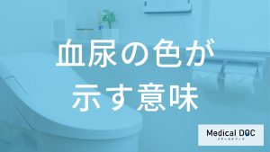 「血尿の色」の違いが示す意味はご存じですか？注意すべき病気も医師が解説！