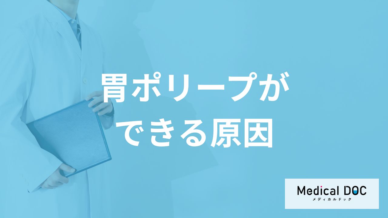 「胃ポリープができる原因」はご存知ですか？医師が解説！