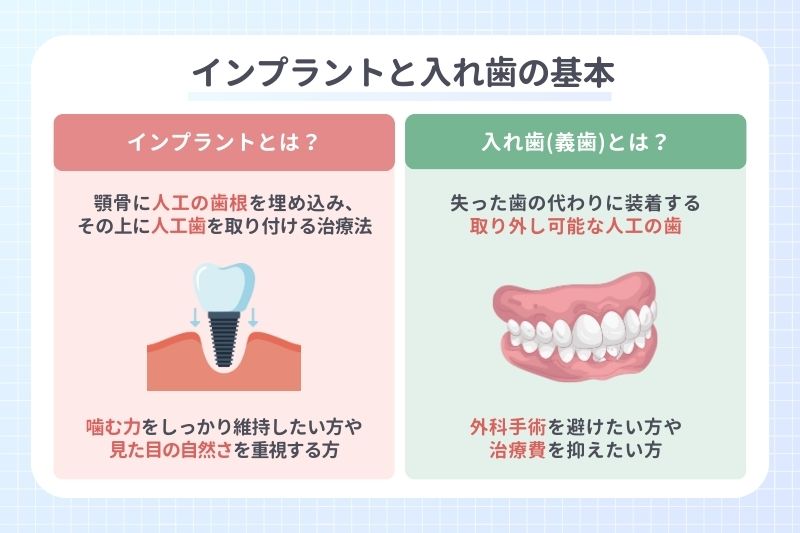 インプラントと入れ歯の基本