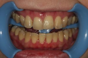 マニーデンタル