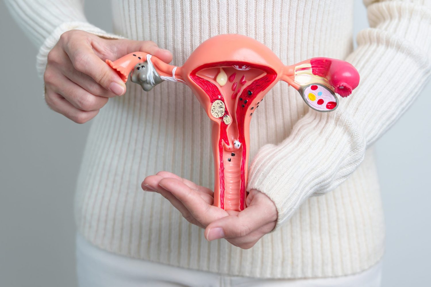 子宮筋腫の概要と治療法