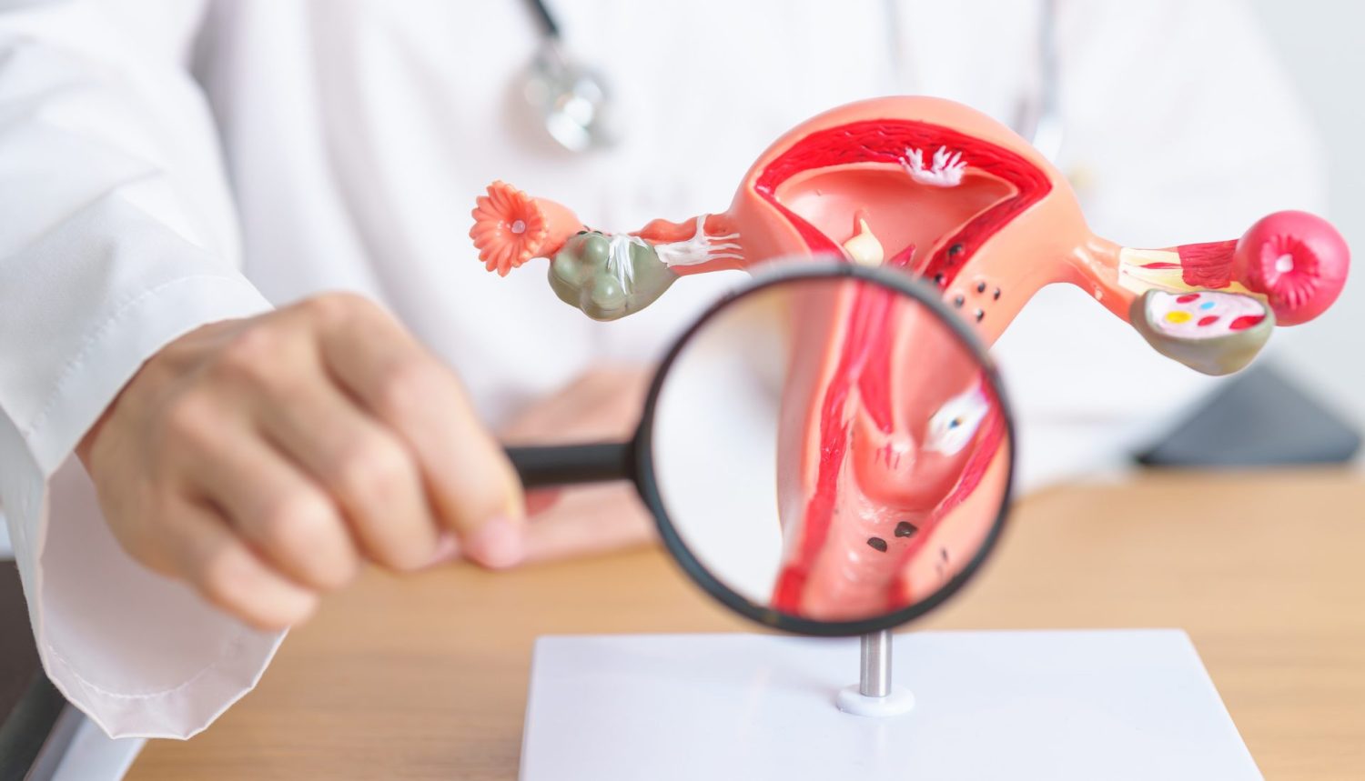 子宮内膜症の治療法