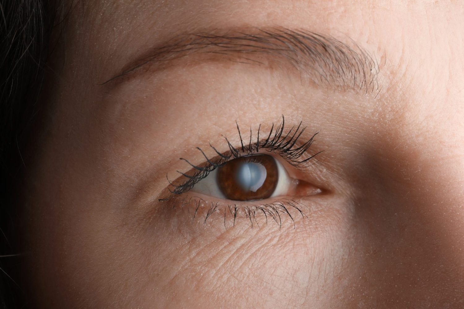 糖尿病により失明する理由と症状の進行