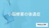 「小脳梗塞」を発症するとどんな「後遺症」が残るかご存知ですか？医師が解説！
