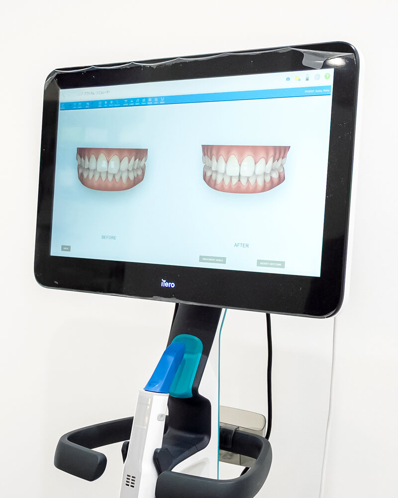 一人ひとりに適切な、オーダーメイドの矯正プラン