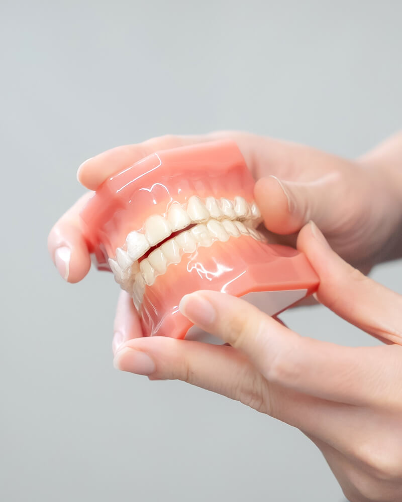 一人ひとりに適切な、オーダーメイドの矯正プラン