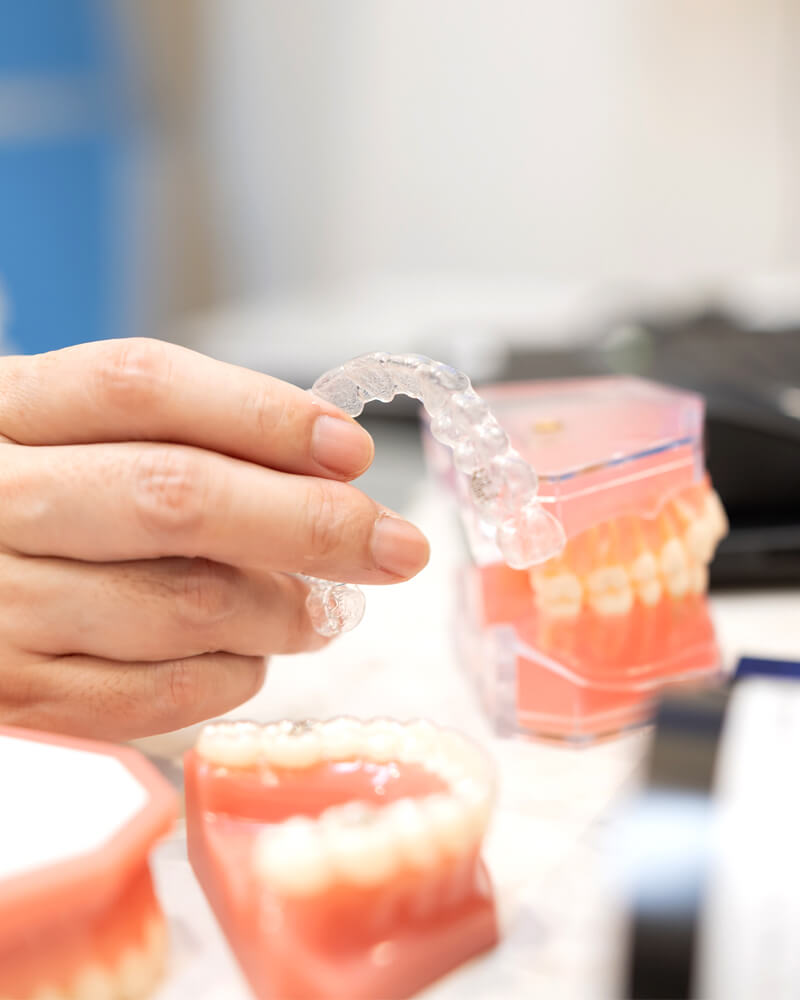 費用が同じならインビザラインよりSMAを選ぶ