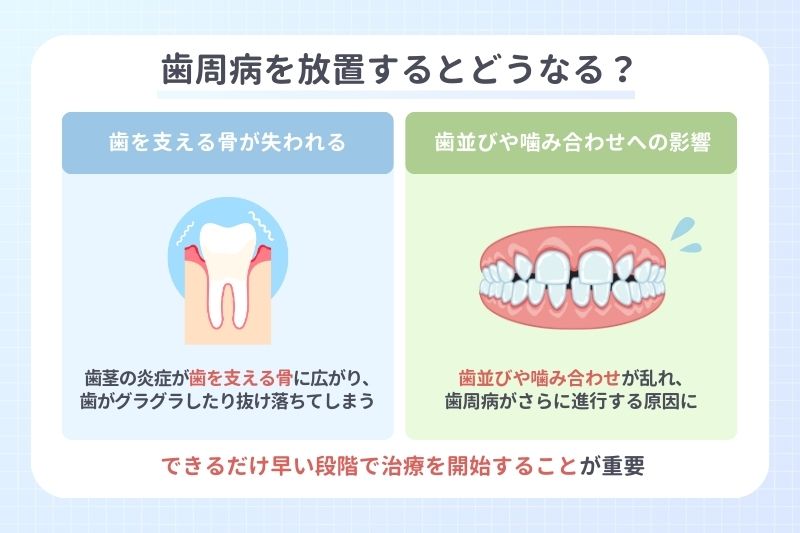 歯周病を放置するとどうなる？