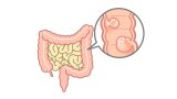 無症状も危険？ 『大腸ポリープ』の特徴と40代から大腸カメラを勧める理由【医師解説】