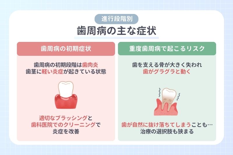 歯周病の主な症状