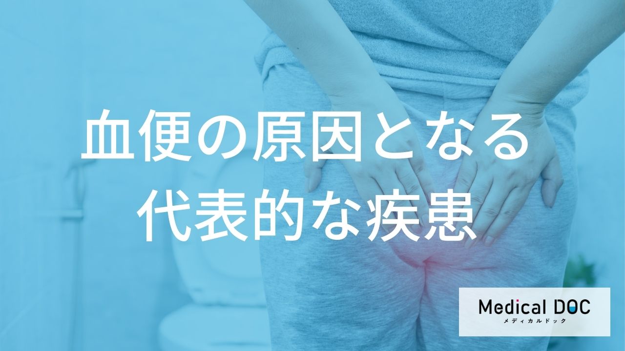 血便の原因となる代表的な疾患