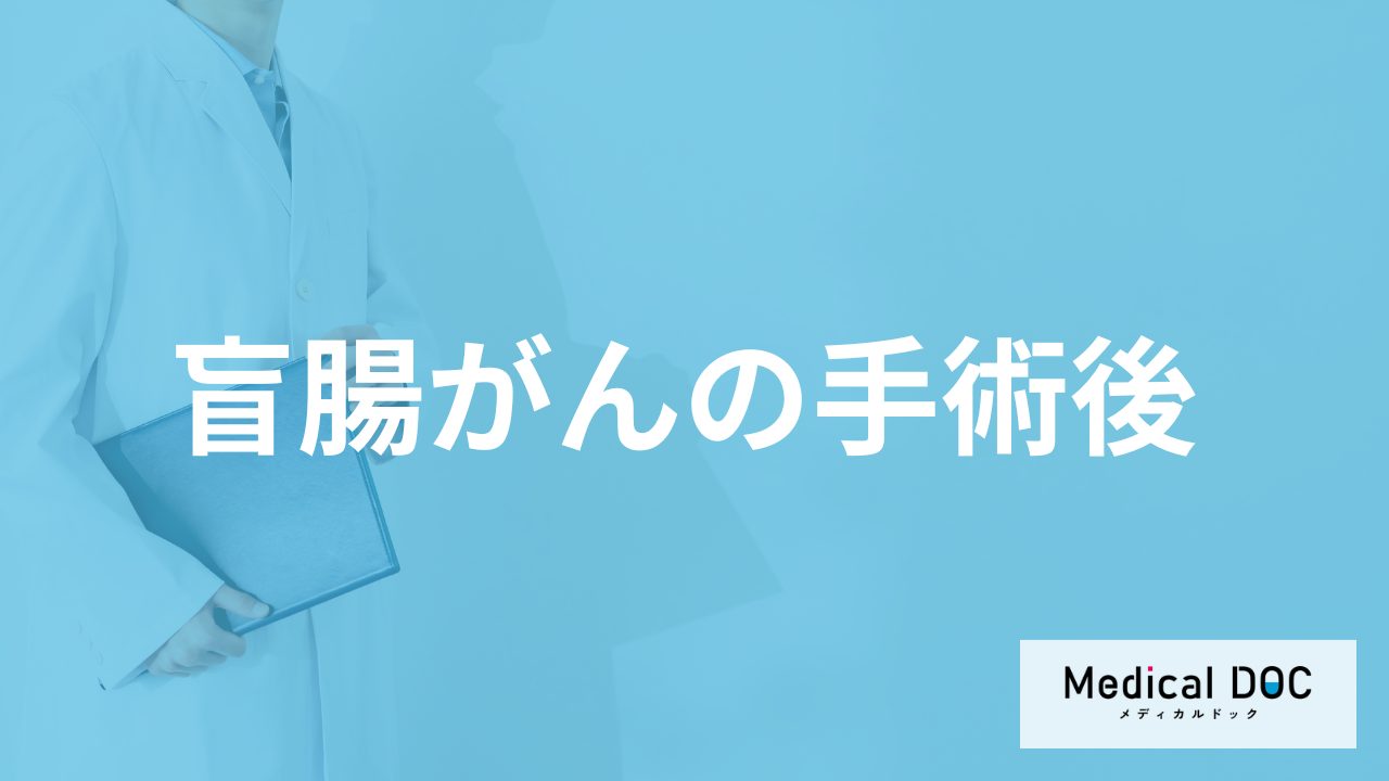 「盲腸がんの手術後」に”腸閉塞を招く食べ物”とは？術後の生活を医師が解説！