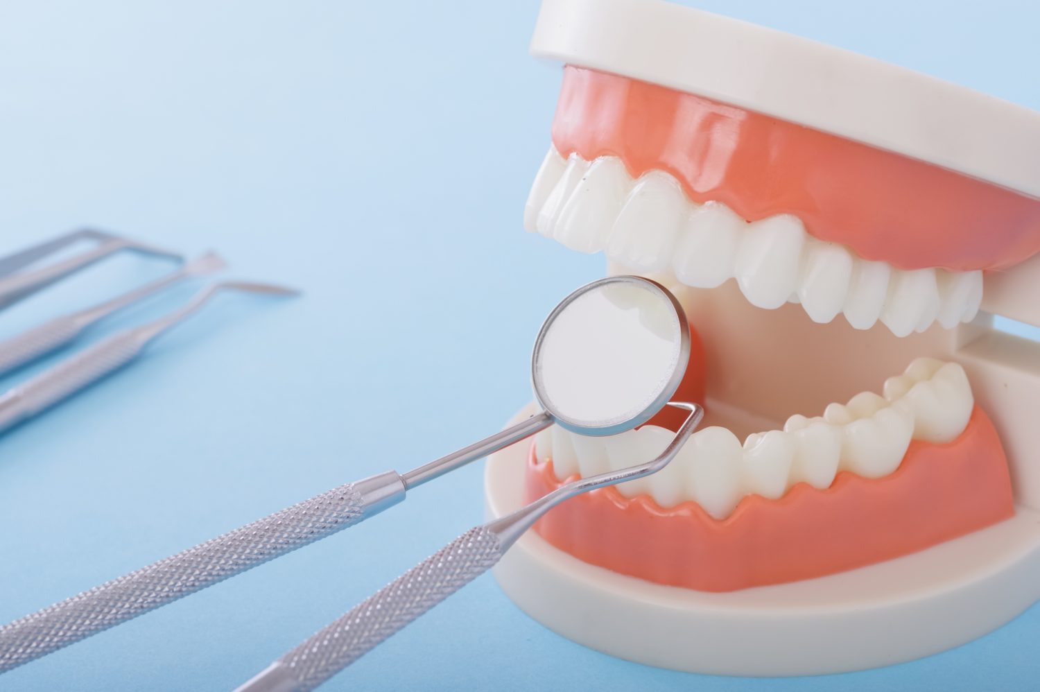 インプラントの緩みを放置した場合に起こり得るトラブル