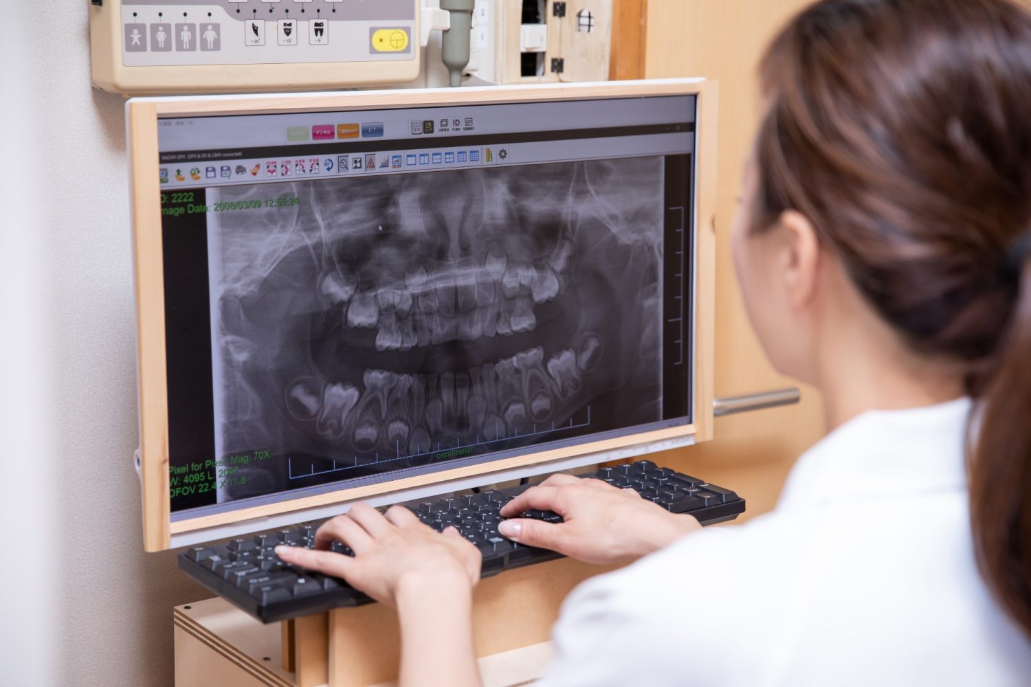 骨造成手術後の痛みと腫れの経過