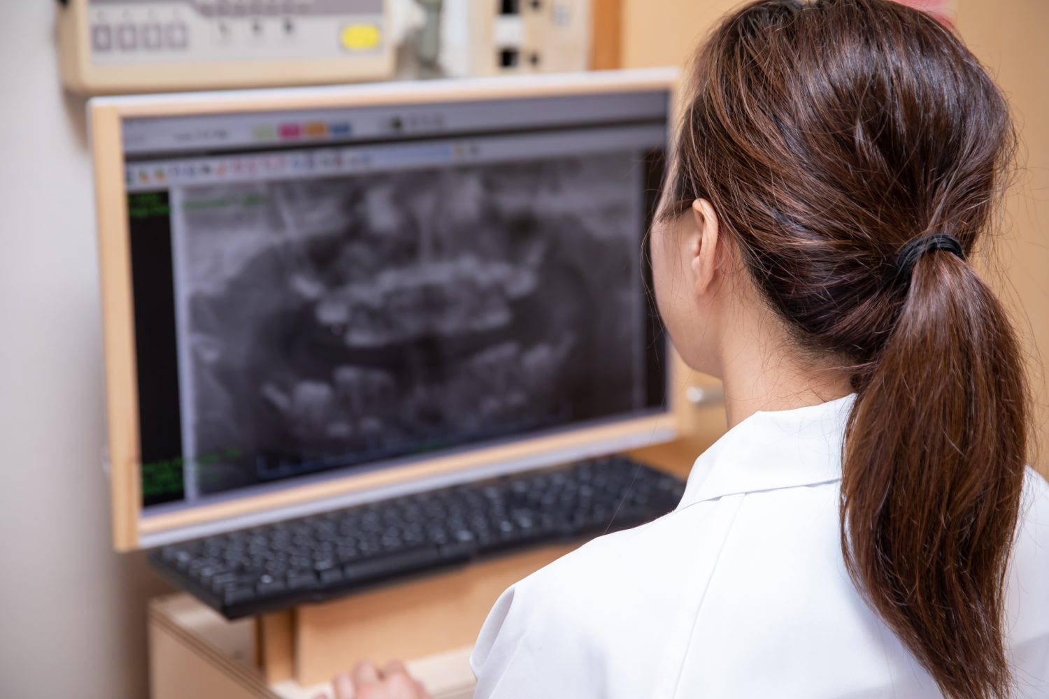 ソケットリフトとサイナスリフトの違いは?治療法の特徴と選び方を解説