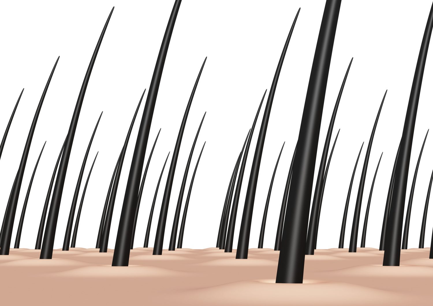 毛の濃さの違いはどこから？