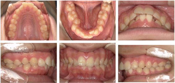 西落合リーフ歯科・矯正歯科