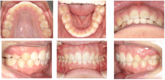 西落合リーフ歯科・矯正歯科
