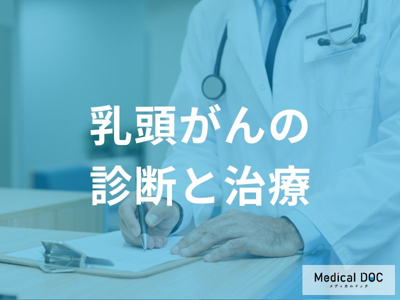 乳頭がんの診断と治療